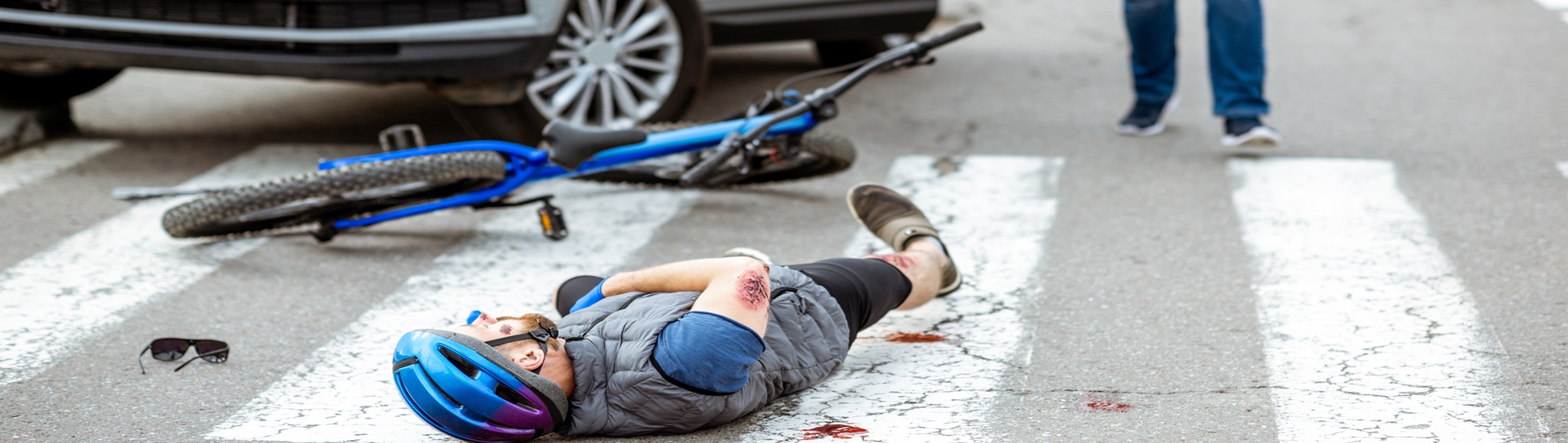 Road Accident With Injured Cyclist And Car Driver
