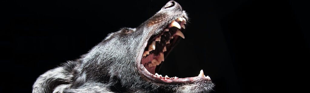 what to do when a dog bites you